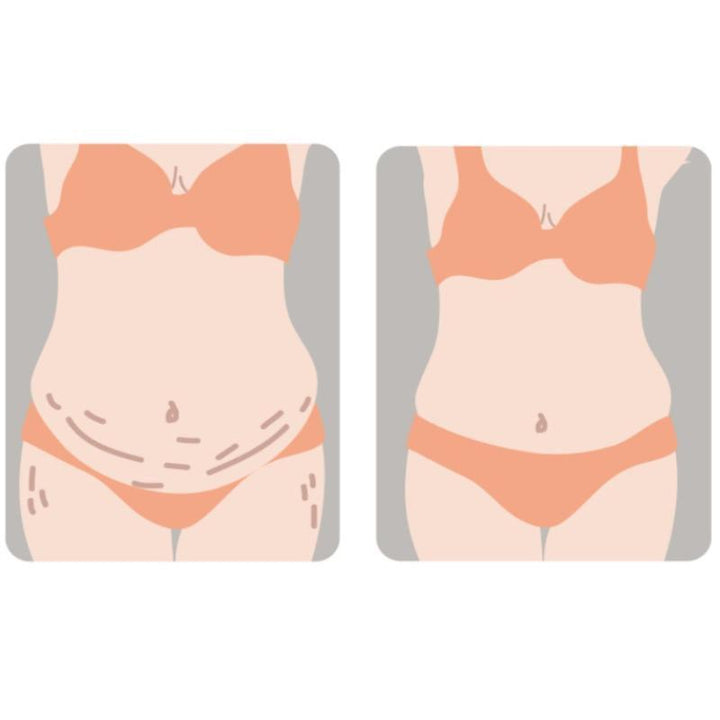 Sunveno Breathable Postpartum Abdominal Belt - L - Zrafh.com - Your Destination for Baby & Mother Needs in Saudi Arabia